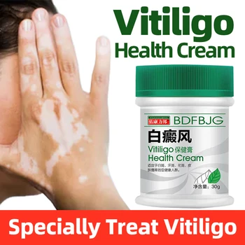 Leukoplakia Zdravljenje Bolezni Mazilo Vitiligom Repair Cream Belo Mesto Kitajske Medicinske Pigment Melanin Balzam Za Nego Kože