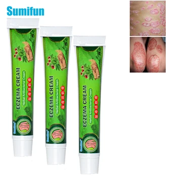 Sumifun 3pcs Zdravljenje Luskavice Krema Protibakterijsko Antipruritic Dermatitis, Ekcem Zeliščna Mazila Anti-srbi Medicinske Mavca