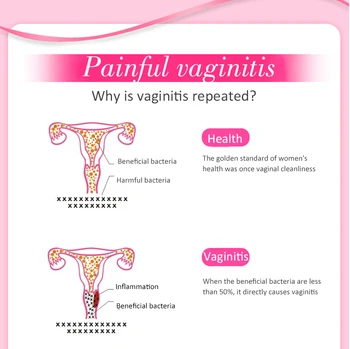6 Tablet/polje Ozko Vaginalne Pomlajevanja Olajšave Vaginalne Sprostitev Probiotiki Skrči Yoni Vaginalne Zaostrovanja Zmanjšati Srbenje