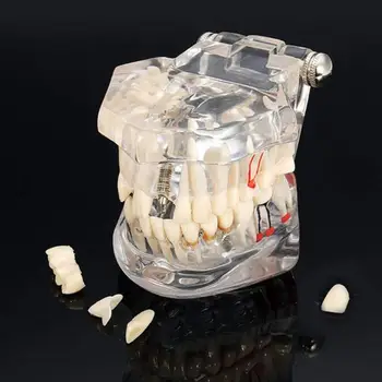 Zobni Ustno Higieno Vsadek Bolezni Zob Model za Medicinske Poučevanja PVC/smole Ustno Zdravje Nega Zob Zob Zob Model
