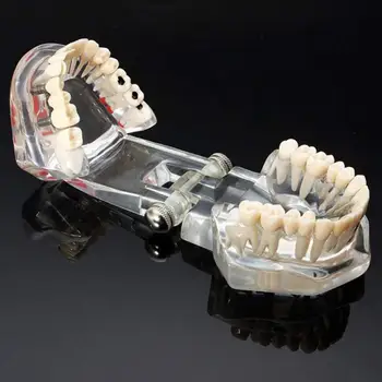 Zobni Ustno Higieno Vsadek Bolezni Zob Model za Medicinske Poučevanja PVC/smole Ustno Zdravje Nega Zob Zob Zob Model