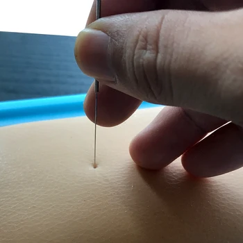 Kitajska Akupunktura, Masaža Učne Prakse Kože Model